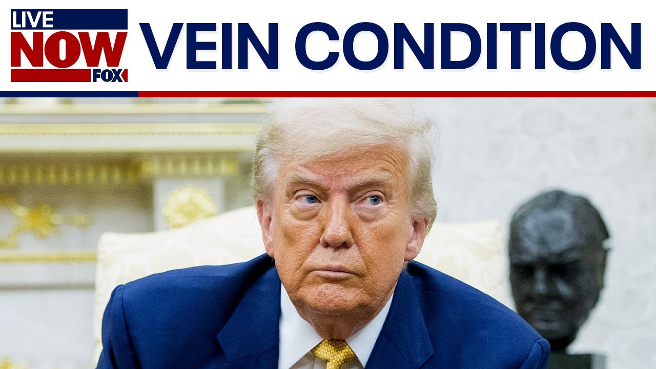 President Trump diagnosed with chronic venous insufficiency: what is it?