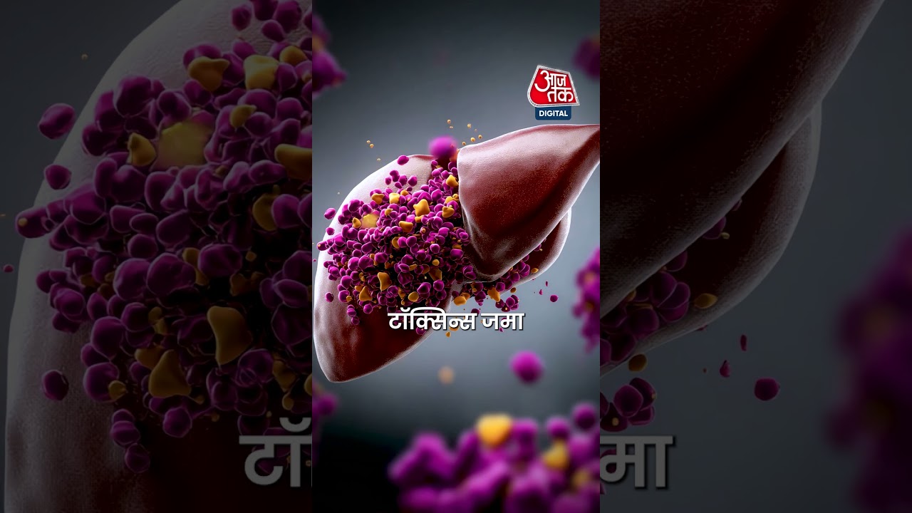 Health News: सुबह की ये आदत कर सकती है आपका Liver फैटी  #aajtak #news #shorts #viral #health