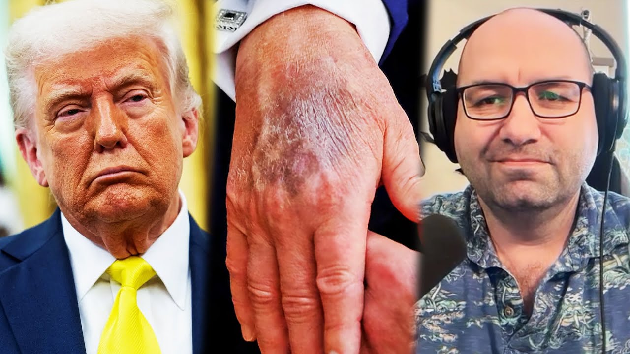 Physical therapist: Trump has 4 months to live