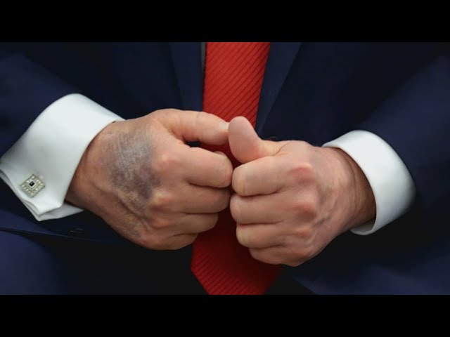 Trump reveals new details about his health in new interview