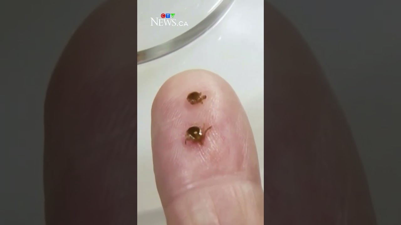 How to protect yourself from ticks