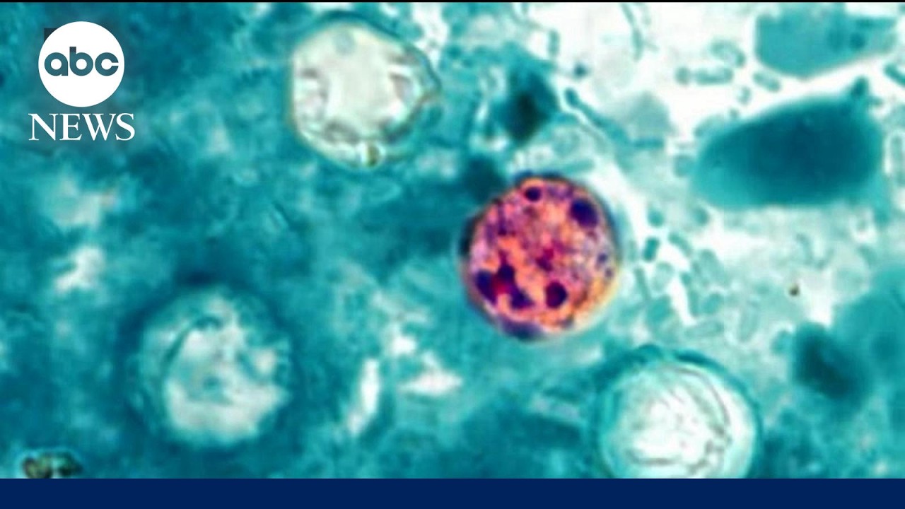 Health alert about cyclosporiasis parasitic infection
