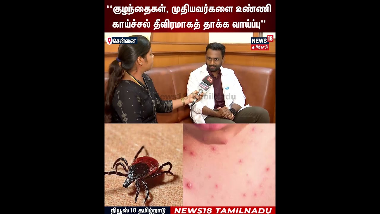 Scrub Typhus | விலங்கு, செடி, கொடிகளில் இருக்கும் உண்ணி கடிப்பதால் உண்ணி காய்ச்சல் பரவும்” | N18S