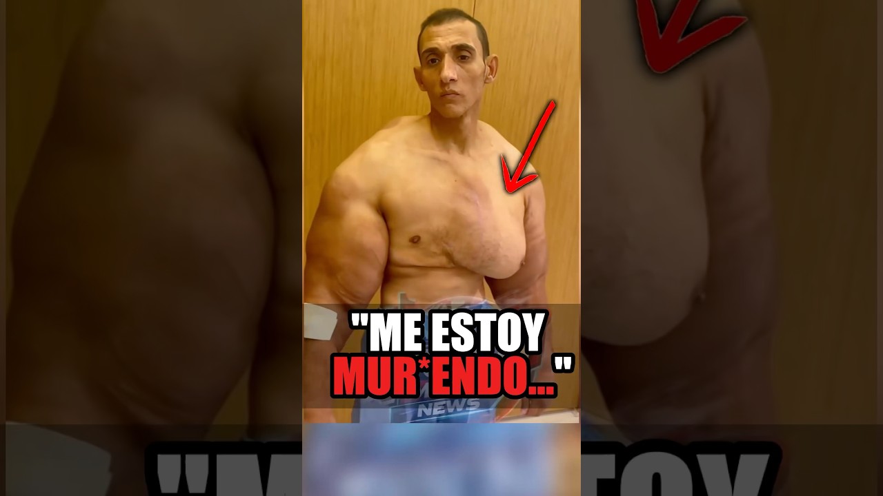 ⚠️ EL SYNTHOL VA A ACABAR CON ÉL😨 #gym #fitness #shorts